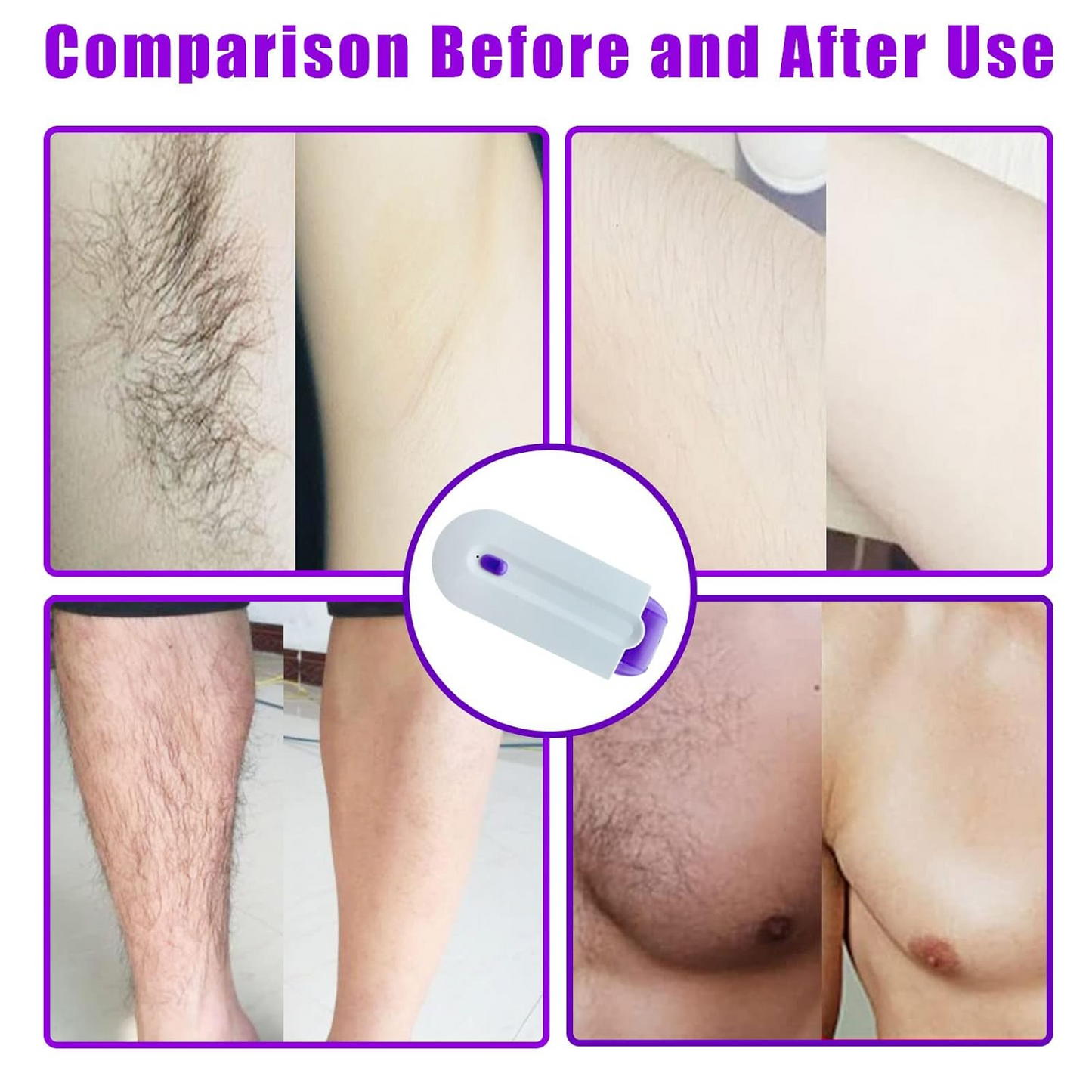 Seurico™ 👩⚕️ Purple Light Beauty Photon Silky Painless Hair Removal